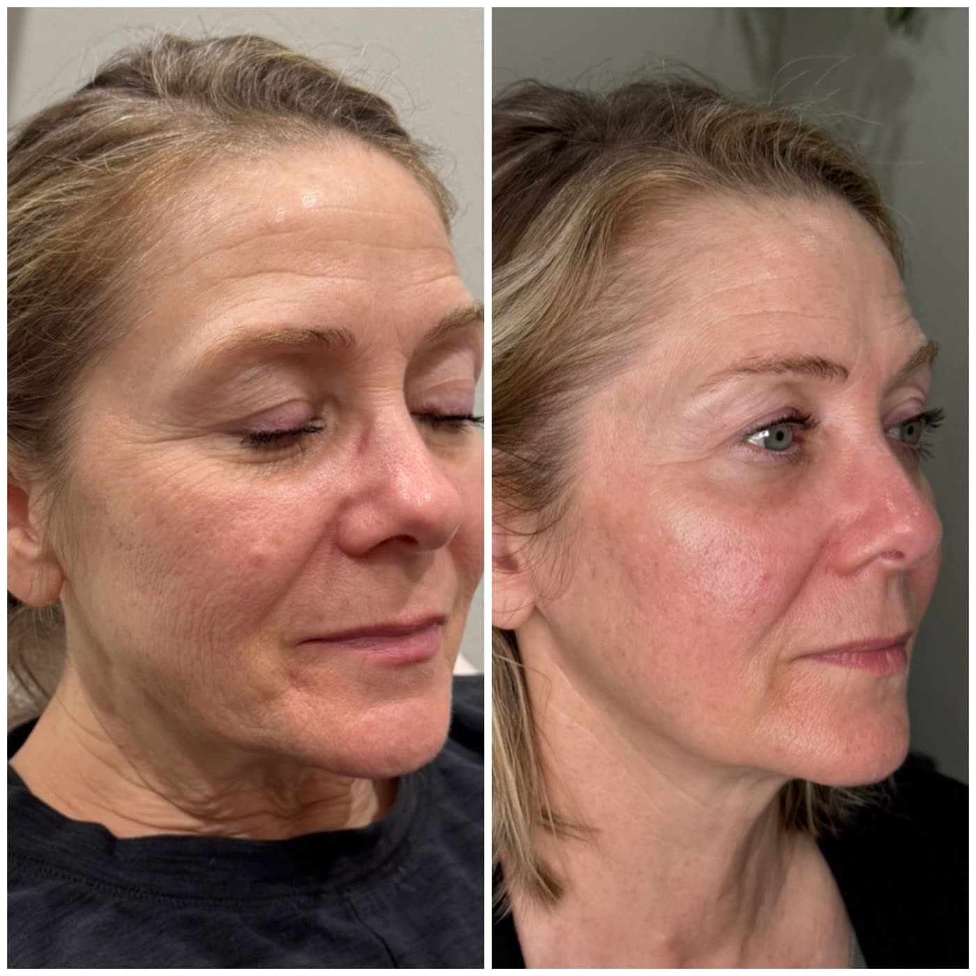 Before and after PlasmaChanneling: three-quarter view, brighter glow and refined texture